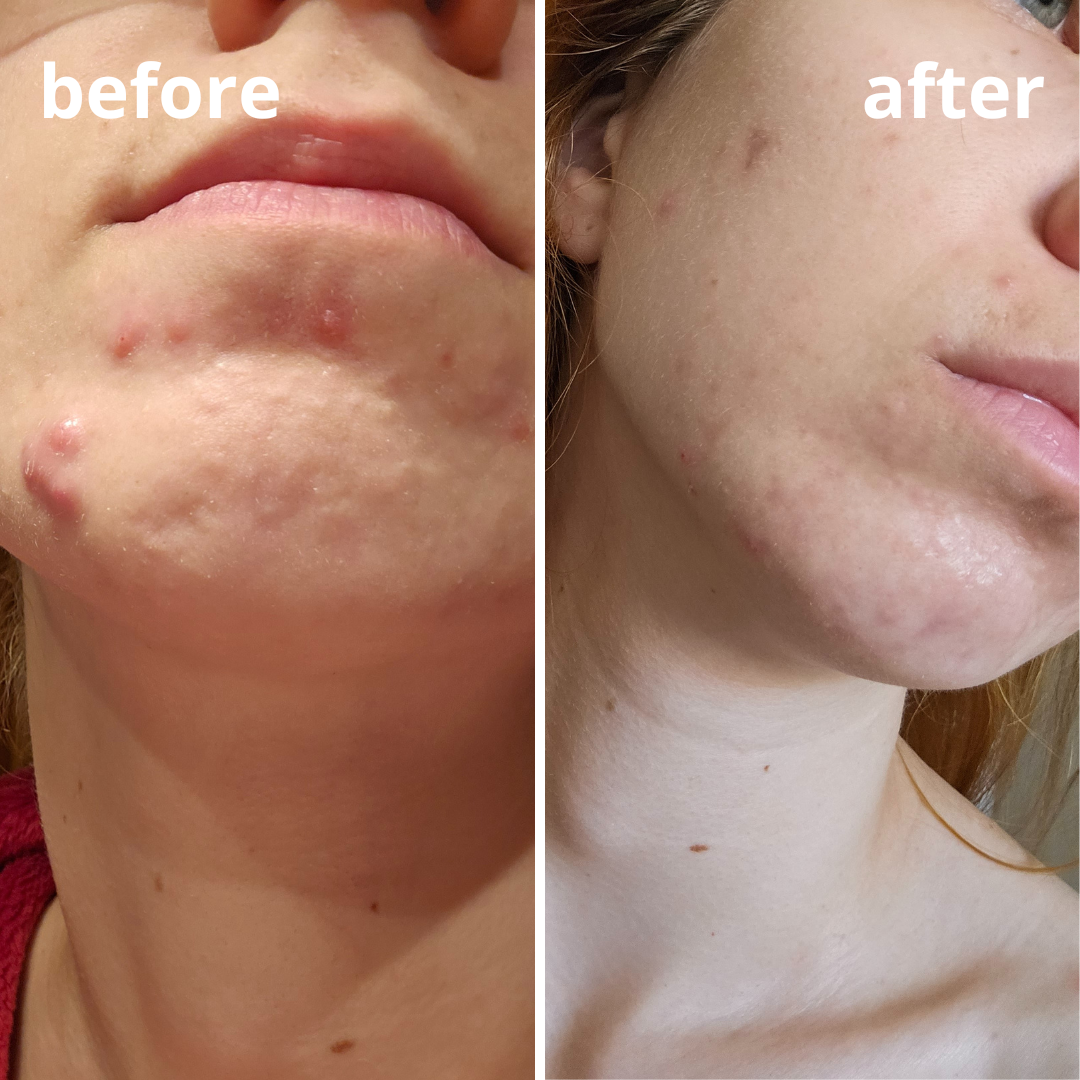 Agnieszka Groza - skin ekspert - kosmetolog