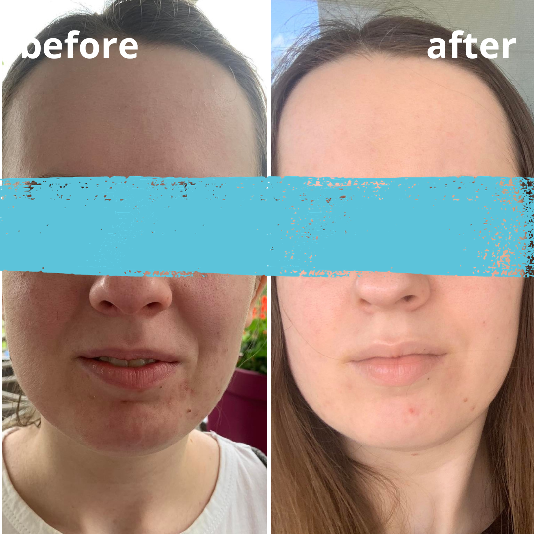 Agnieszka Groza - skin ekspert - kosmetolog