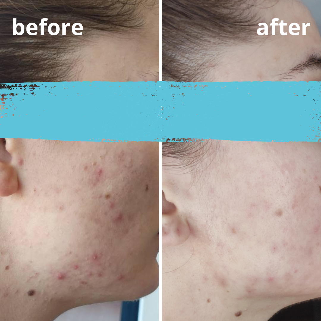 Agnieszka Groza - skin ekspert - kosmetolog