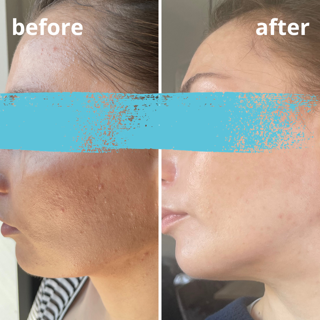 Agnieszka Groza - skin ekspert - kosmetolog