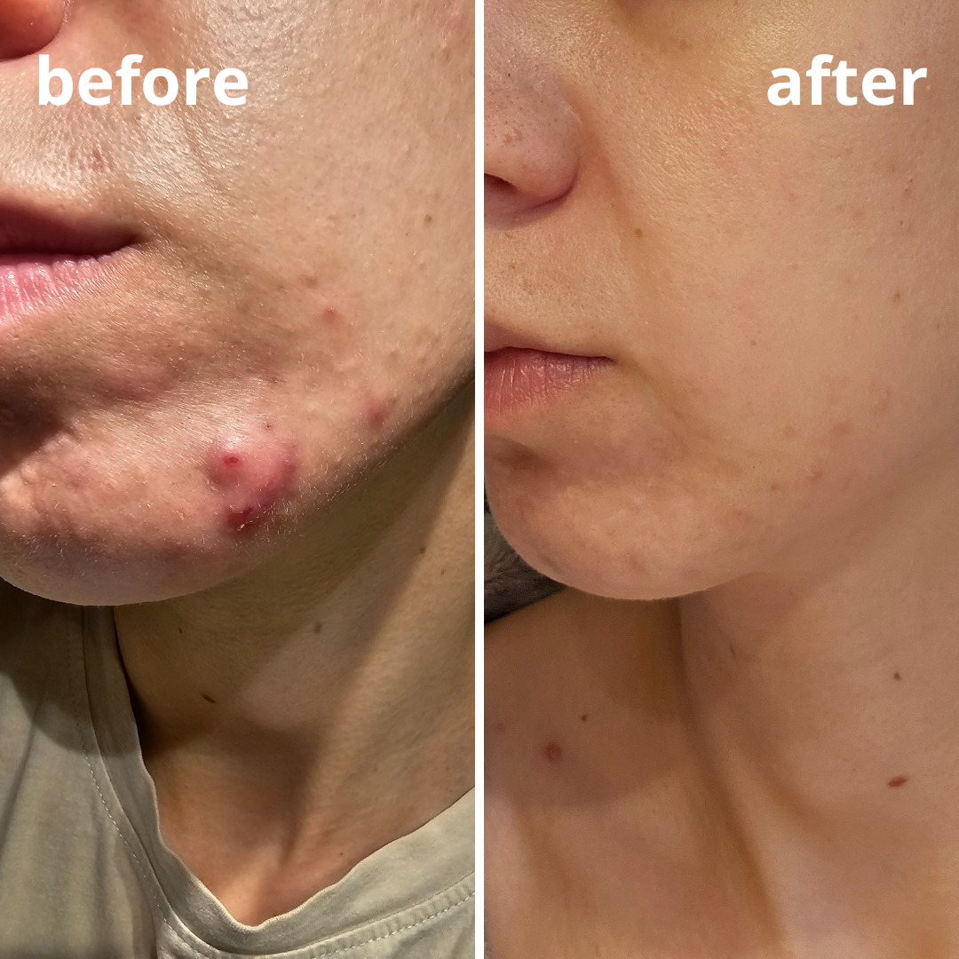 Agnieszka Groza - skin ekspert - kosmetolog