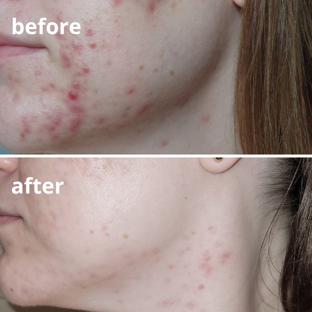 Agnieszka Groza - skin ekspert - kosmetolog