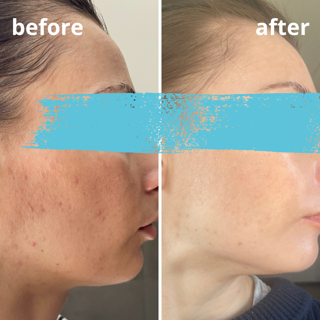 Agnieszka Groza - skin ekspert - kosmetolog