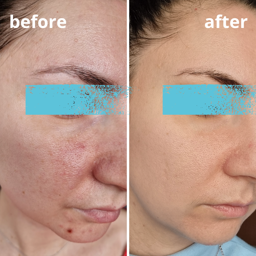 Agnieszka Groza - skin ekspert - kosmetolog