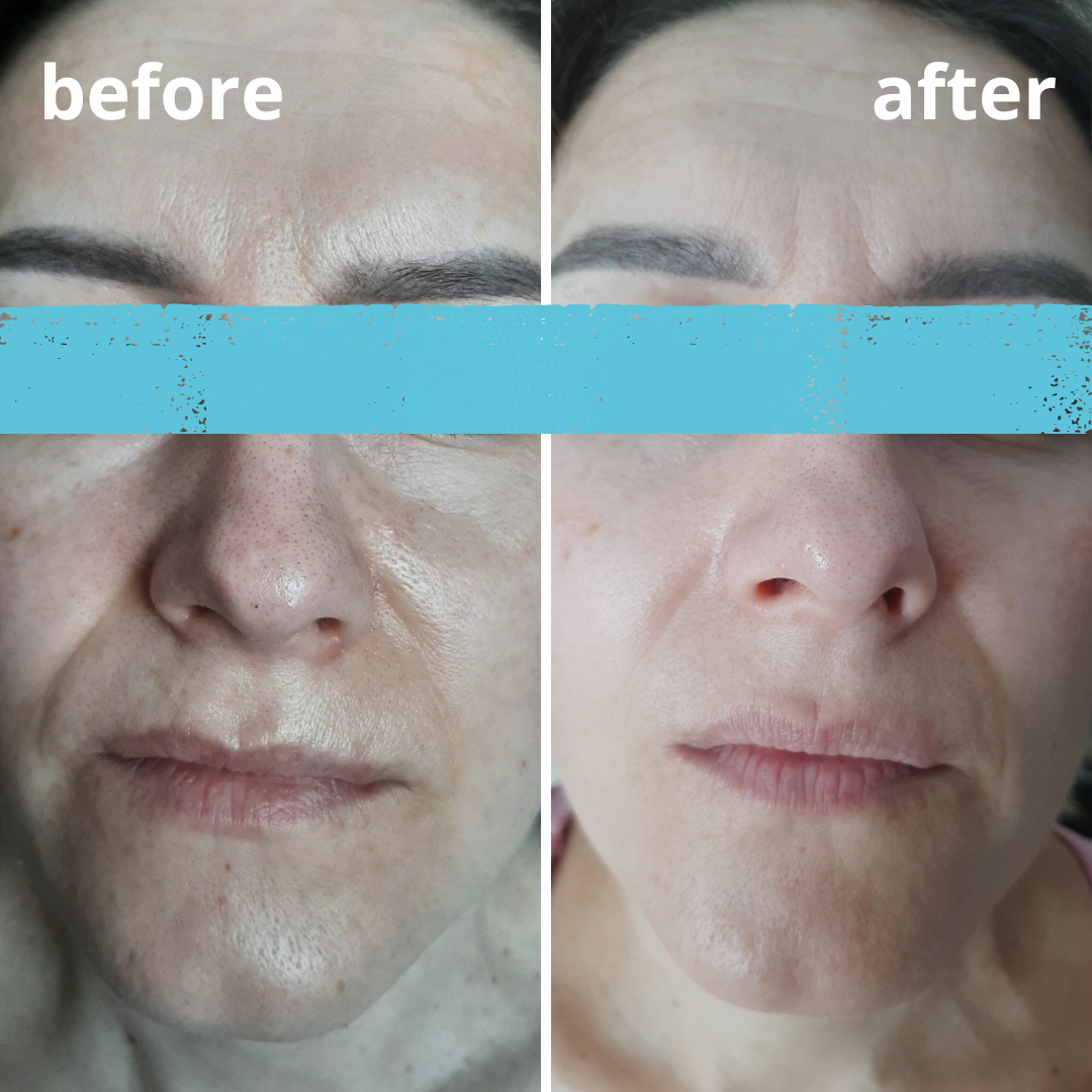 Agnieszka Groza - skin ekspert - kosmetolog