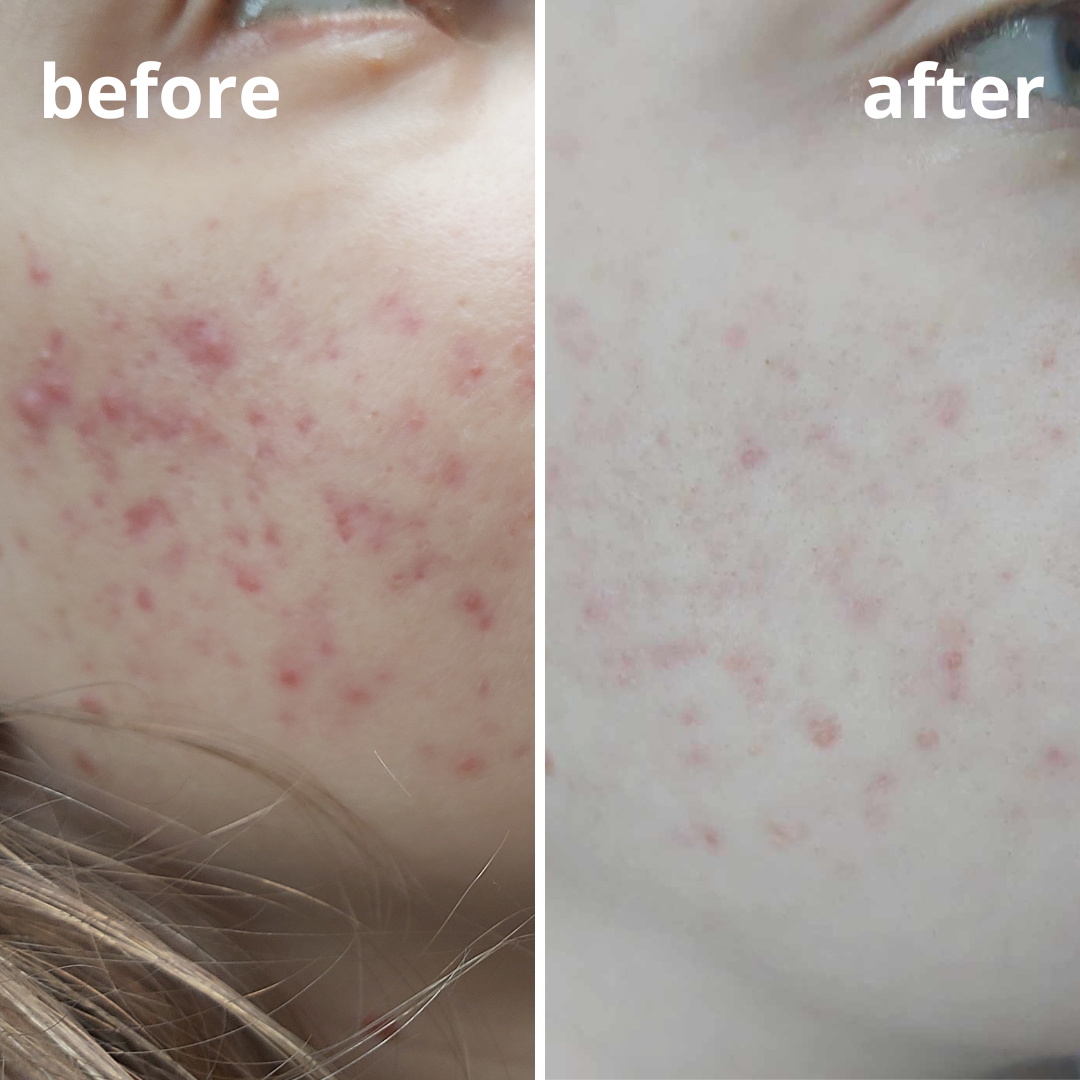 Agnieszka Groza - skin ekspert - kosmetolog