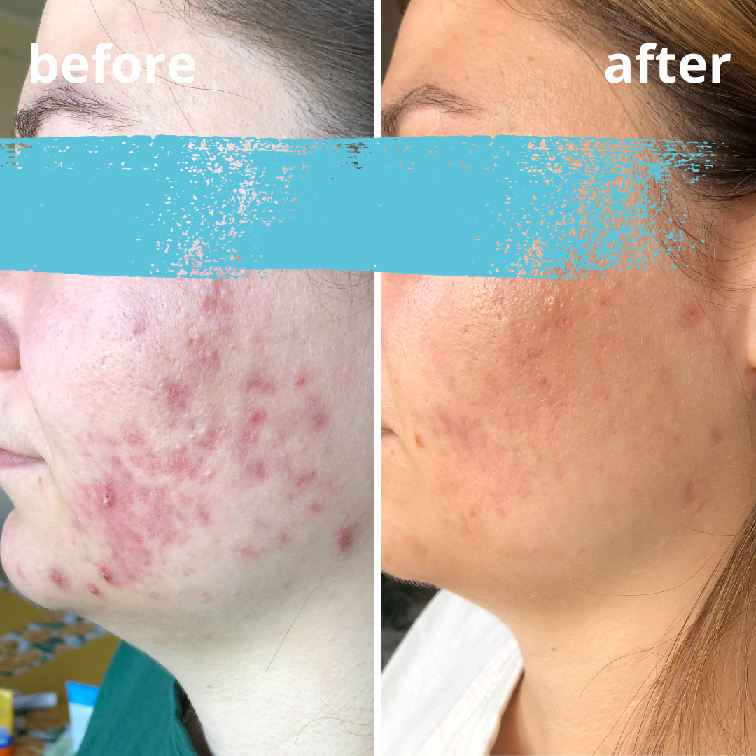 Agnieszka Groza - skin ekspert - kosmetolog