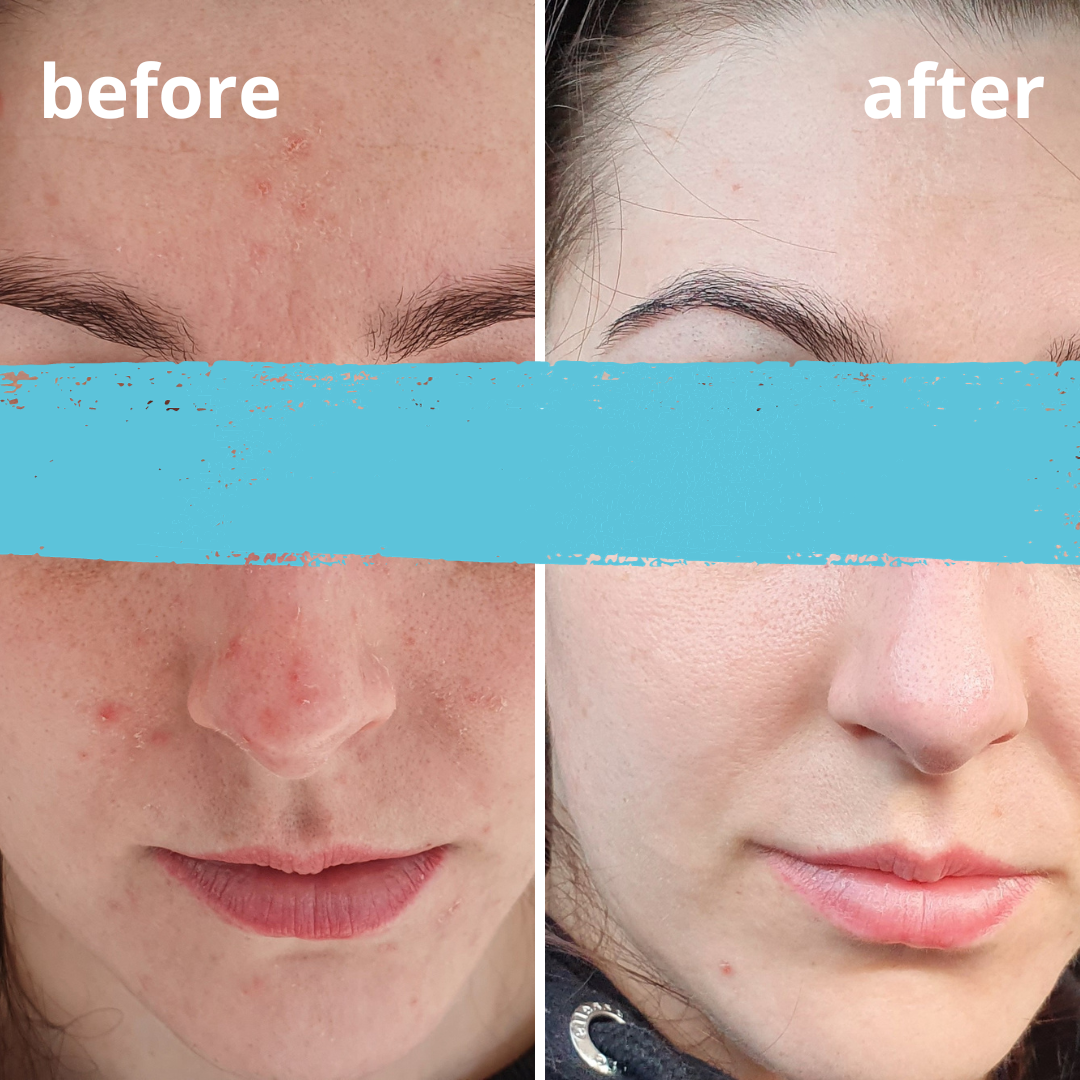 Agnieszka Groza - skin ekspert - kosmetolog