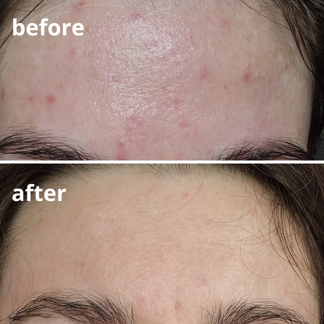 Agnieszka Groza - skin ekspert - kosmetolog